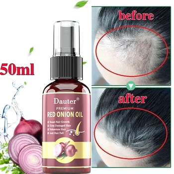 Натурален спрей против косопад с етерично масло - стимулира растежа на косата, Предотвратява загубата на коса, масло за лечение на кожата на главата, мъже, жени